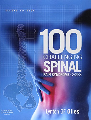 100 Challenging Spinal Pain Syndrome Cases