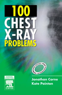 100 Chest X-Ray Problems, International Edition